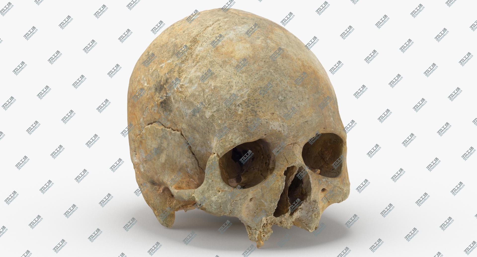 images/goods_img/202104023/Real Human Skull Cranium with Leprosy 01 3D model/2.jpg
